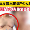 男大学生长出饱满“少女胸”，缩小后竟然长这个样子