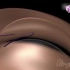 【3D动画演示】埋线双眼皮手术原理