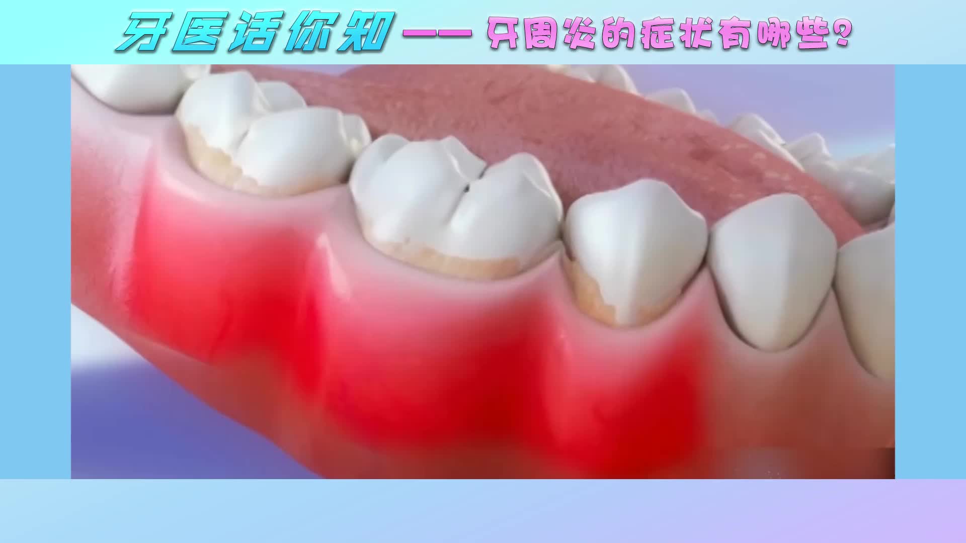 牙龈问题，牙周病如何自我治疗？ - 知乎
