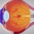 青光眼的发生原理，3D演示。。