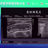 儿童急腹症超声检查诊断规范探讨-贾立群