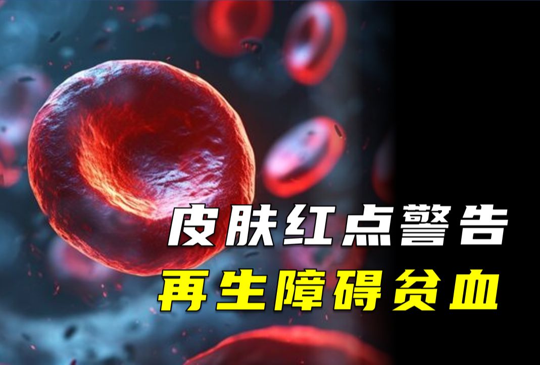 莫名出现的皮肤红点，血细胞的缺乏会带来多严重的影响？【再生障碍性贫血】