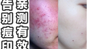 89968a406f1ffa3f6a2ce1984449f9b0a5fbb6b8.jpg@280w_158h_1c_100q.jpg