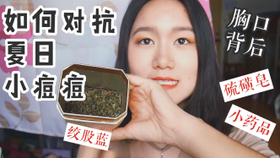 8bb3f7c48da82cdbc711be7898f38d3b9f2760bf.png@280w_158h_1c_100q.jpg