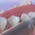 国外大神制作3D动画演示洗牙过程，告诉你牙结石是怎么被消灭的