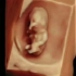 胎儿在妈妈肚子里翻滚玩脐带的日常/杭州玛莉亚新生儿