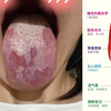 25岁小姑娘，手淫5年，舌苔严重剥落，神仙都难救