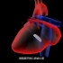 心脏瓣膜置换演示动画（辽宁石油化工大学学生作品）