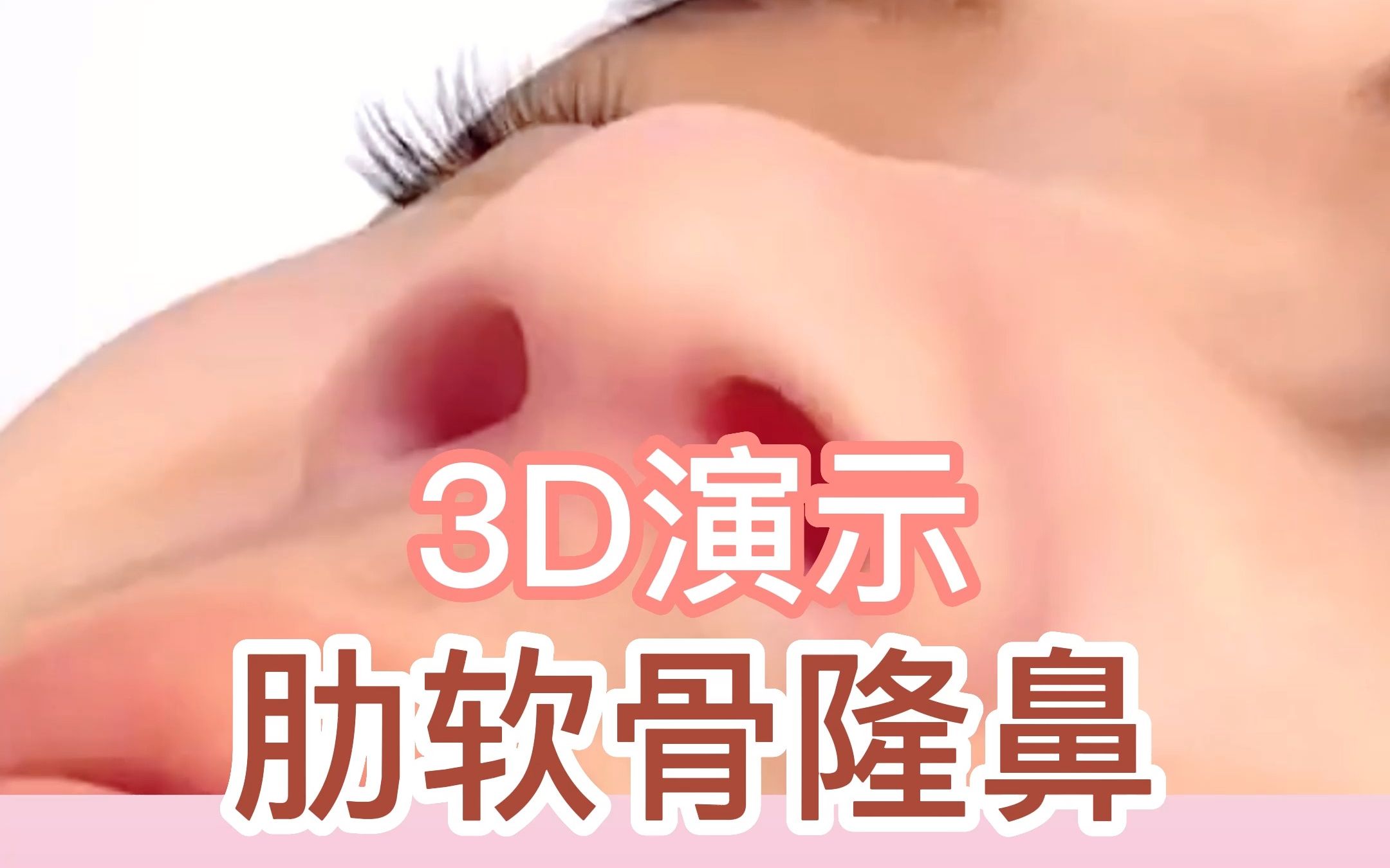 3D演示鼻整形全部过程，看完你想做鼻子吗