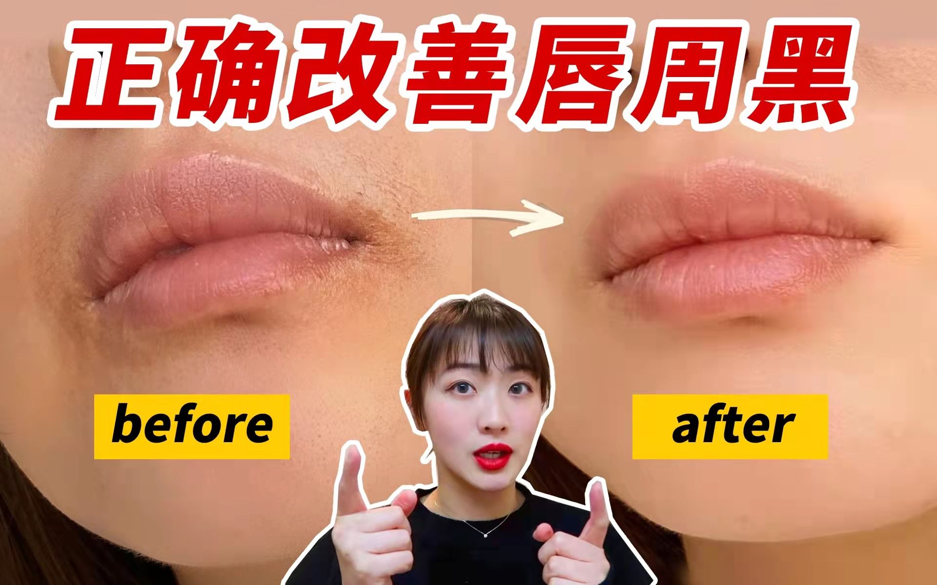 唇周暗沉别瞎折腾！美容师教你2步科学去黑！秒变索吻唇