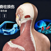 车祸怀疑脊髓损伤，千万别拉拽或者背伤者