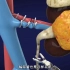 机器人肾切除手术过程，3D演示。。