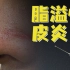 【杨希川教授】鼻翼和眉心脱皮又泛红，怎样才能治好呢？