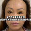 为了美，女人能有多拼？看这位59岁美国姐姐万里迢迢直冲大拉皮