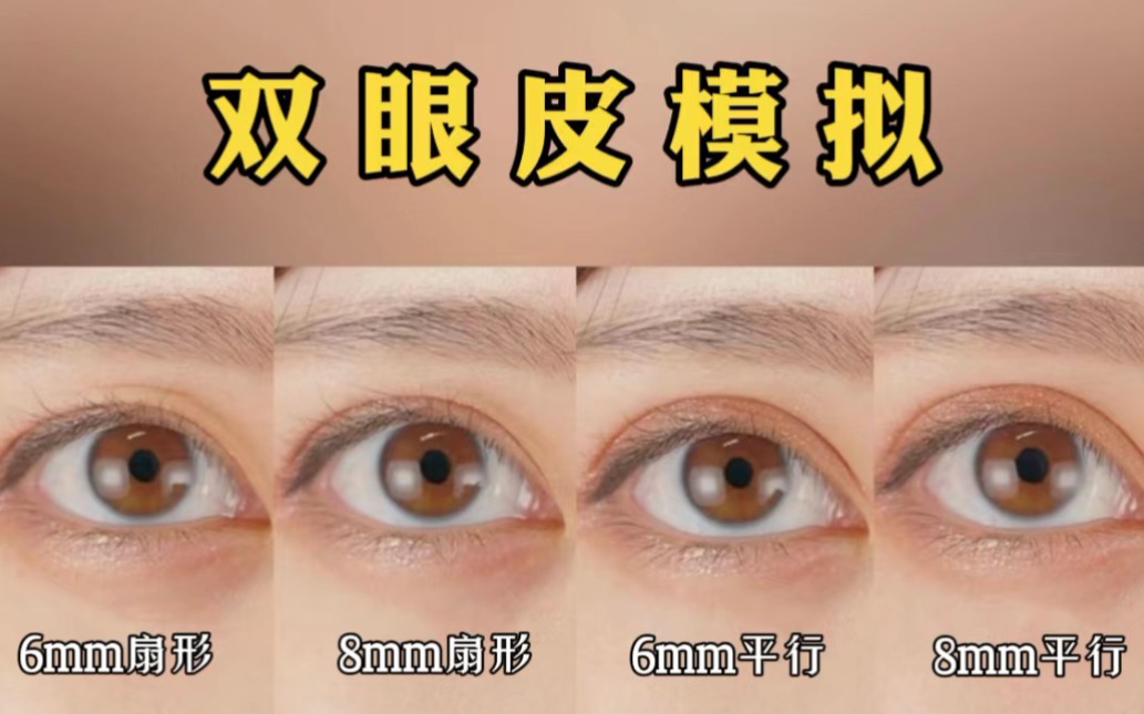 模拟了6mm、8mm的双眼皮，该如何选择？