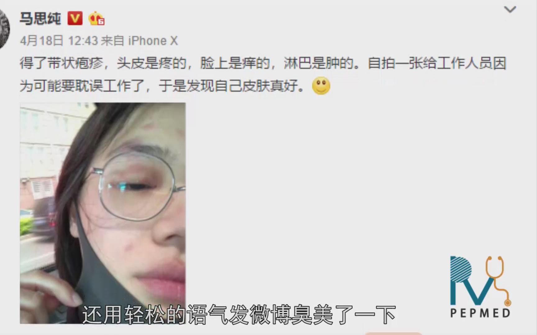 蔡依林、马思纯都被这个病放倒了!带状疱疹到底是啥?
