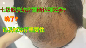 96a6a35a4694560ca24b0220a91752d7434dcd95.jpg@280w_158h_1c_100q.jpg