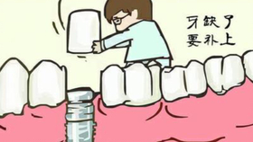 种牙多长时间就不出血了 986a648c31a2aae57c62cd0ce5967ef6faef5f72.jpg@280w_158h_1c_100q.jpg