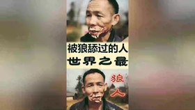 9a7b7b59d464b99c769783d5c497893d660f118e.jpg@280w_158h_1c_100q.jpg