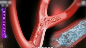 什么样子的人容易得精神病 9b349faeed571f024b3f07fa53eea5013fc1faa2.jpg@280w_158h_1c_100q.jpg