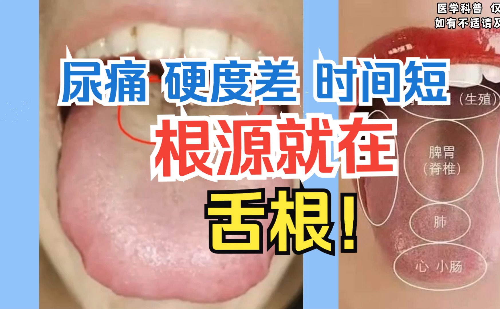 舌诊案例：尿痛 硬度差 时间短 中医：所有问题的根源就在舌根！