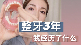 9d022150d36ba6e6d3a541b724f1a4505a246c45.png@280w_158h_1c_100q.jpg