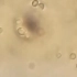 显微镜放大酵母菌400倍