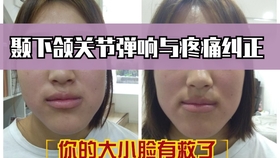 9eeb7da490a0b19e5acbb245b806014b27275479.jpg@280w_158h_1c_100q.jpg