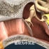 3D科普演示 分泌性中耳炎的病症形成原因