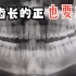 29岁男子智齿虽然长的正，但是经常发炎疼痛，要求医生拔牙