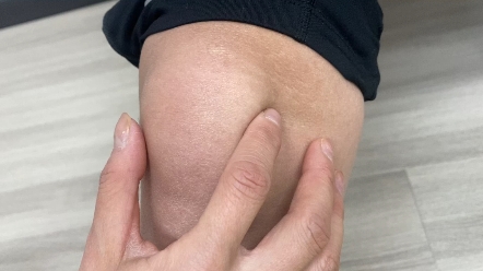 如何解决膝盖内侧疼痛