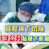 宫腔镜切除13cm的子宫肌瘤