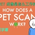 【中英字幕】为什么医院的PET检查那么贵？4分钟了解啥是PET成像！