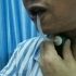 全喉切除术后，患者应用气动式人工喉发音