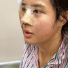 新疆小姐姐来做鼻子了，从普女到明星的全过程