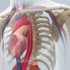 主动脉球囊反搏（IABP）手术过程,3D演示。。
