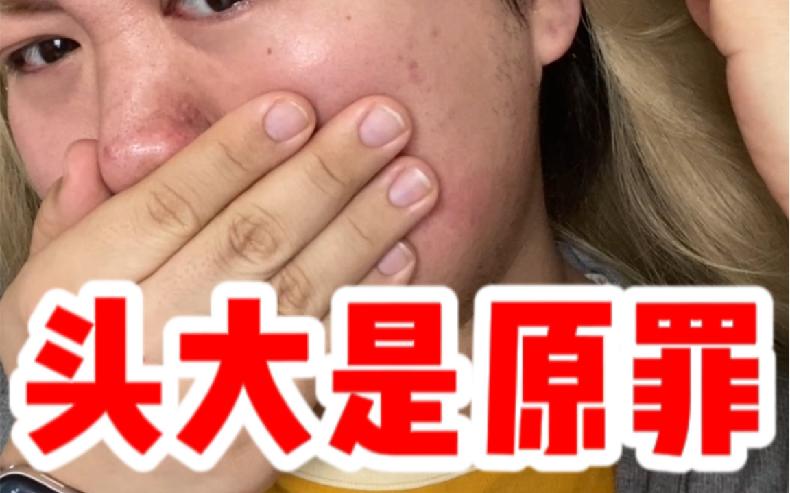 大头围星人集合！找到假发戴不下的解决办法了