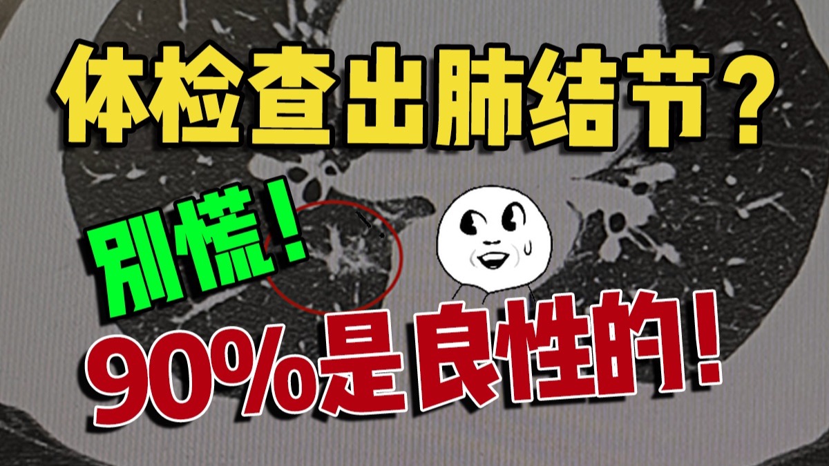 体检发现肺结节先别怕！90%是良性的！医生教你读懂报告
