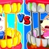 沃尔夫动画：大金牙VS大灰牙 小狼的牙齿护理过程,你学会了吗？