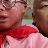 早读课朗朗的读书声没想到爸爸三十几岁了还能体验到，濛濛咋又流眼泪了，讨厌的鱼鳞病