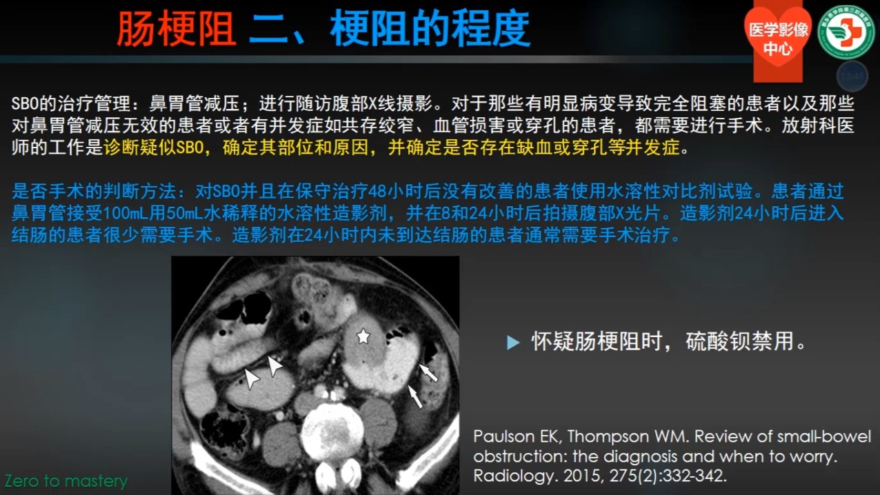 第十五讲、肠梗阻总论01（共30讲）