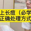 脸上长了痘痘怎么办？学会正确处理方式很重要