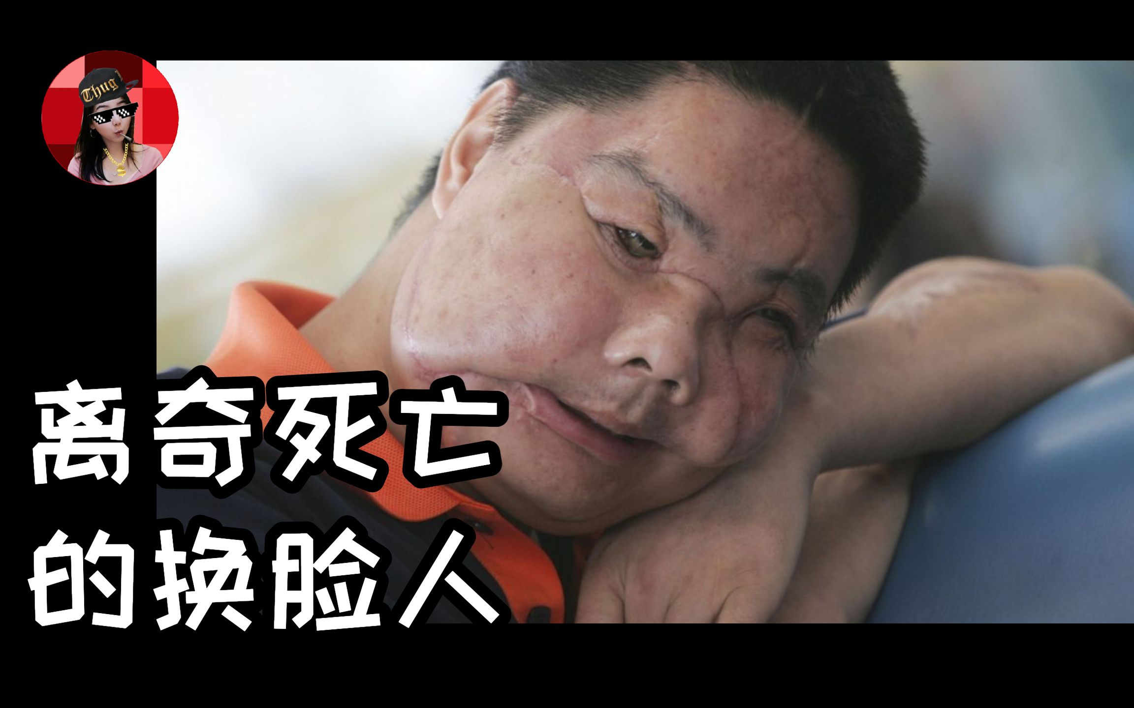 中国首例换脸人李国兴，手术成功后竟然离奇死亡，揭秘换脸术