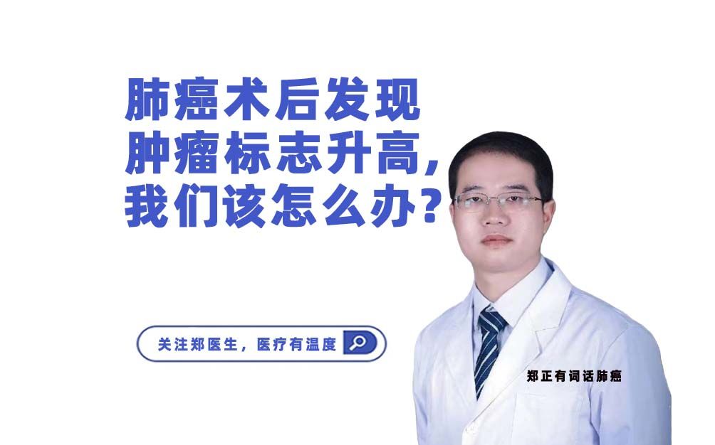 肺癌术后发现肿瘤标志升高,我们该怎么办?哔哩哔哩bilibili