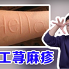 一抓就红，越抓越痒の人工荨麻疹