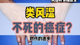 a8fac4b07b55a59a1f146f9fce1af7804fb48b8c.jpg@280w_158h_1c_100q.jpg