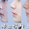 这几种鼻子你最pick哪一款❓#鼻综合 #鼻修复医生#肋骨鼻 #杭州鼻子#杭州鼻子医生 #上海鼻修复#妈生鼻 #驼峰鼻#鼻型#鼻模板 #肋骨鼻 #驼峰鼻