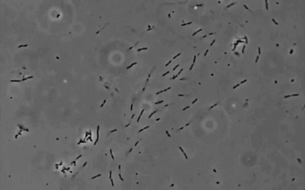 细菌分裂（延时摄影）