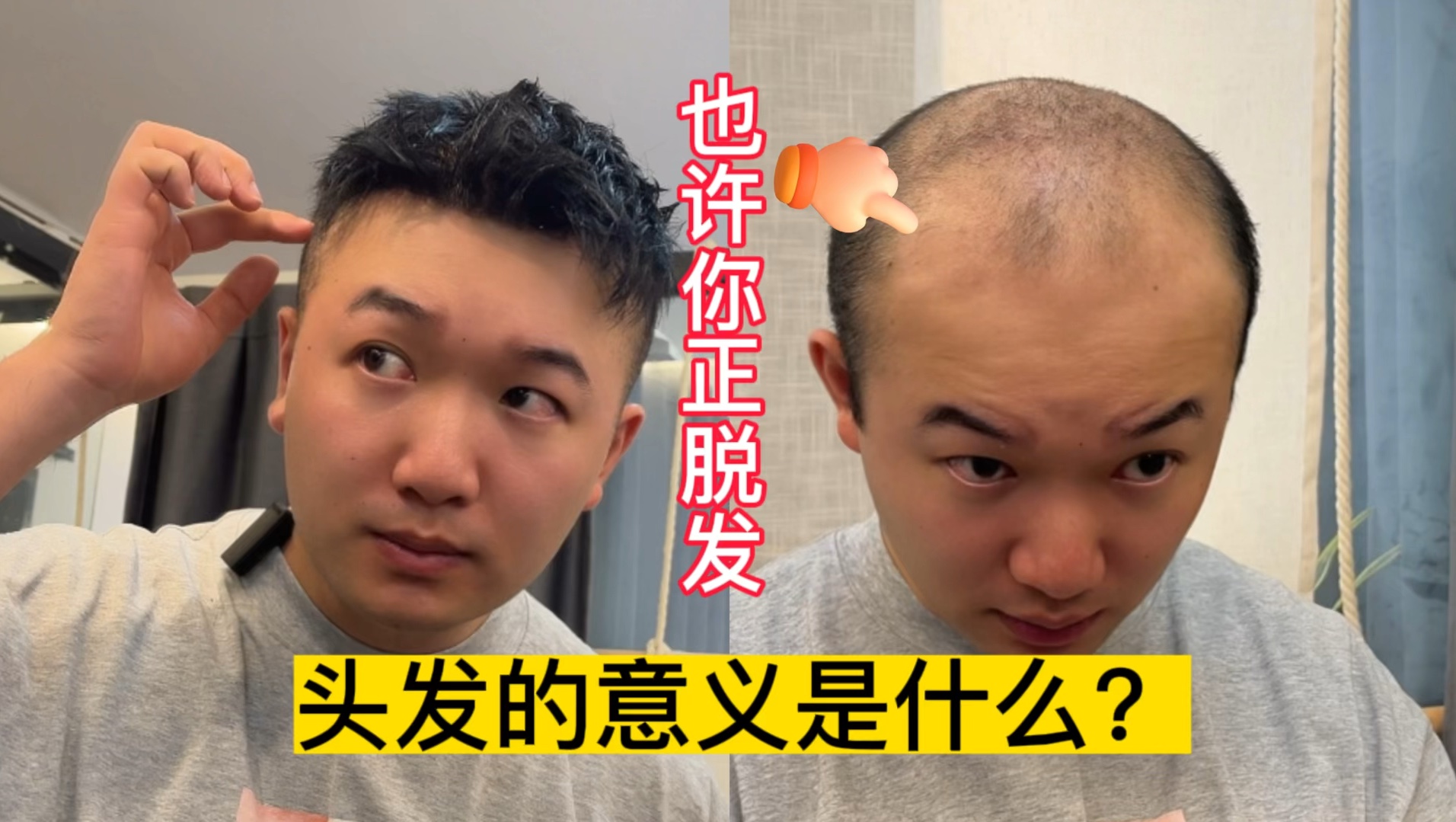 对于脱发的你来说头发的意义是什么？