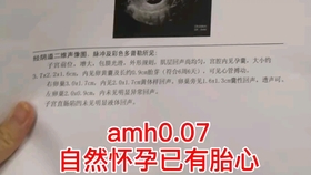 ab18ffc3bfb0bacb4369abbd92f03a40f1d3db02.jpg@280w_158h_1c_100q.jpg